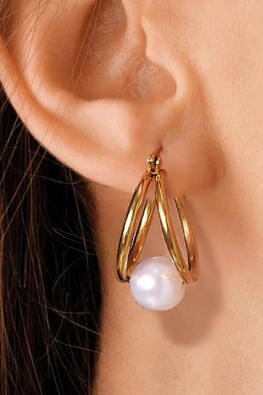 Aretes