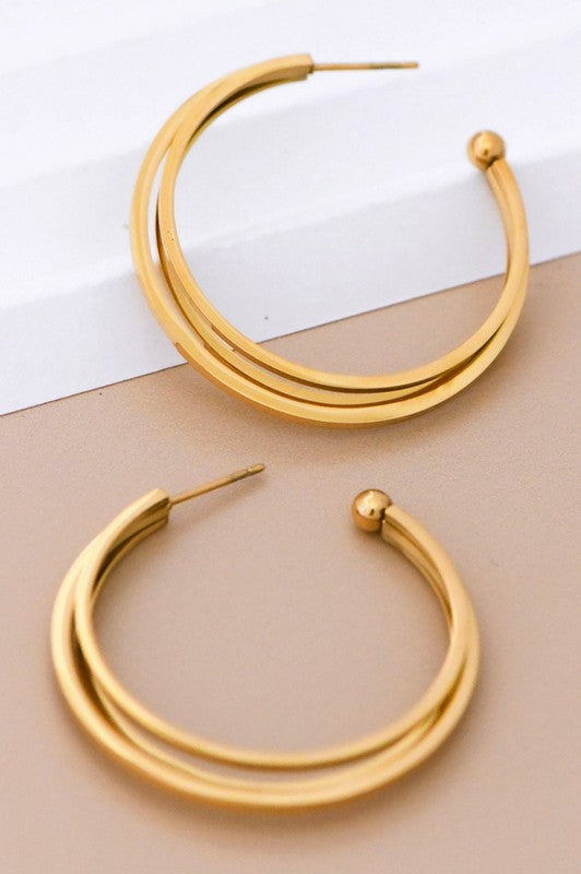 Aretes