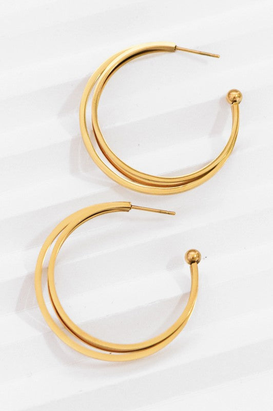 Aretes