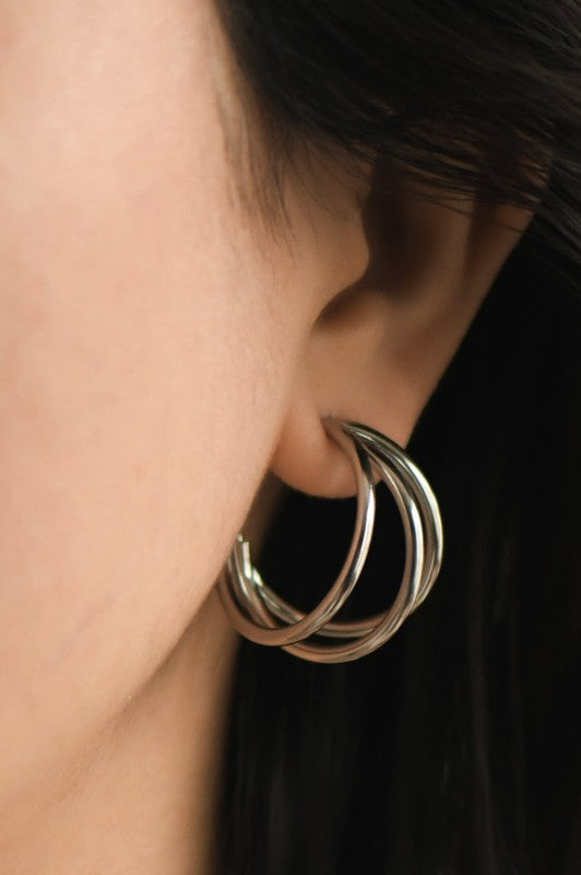 Aretes