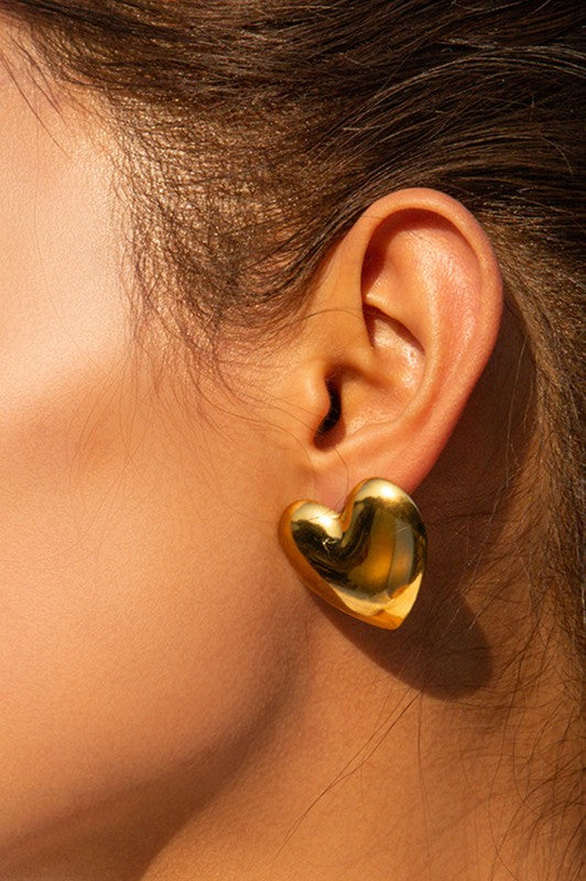 Aretes